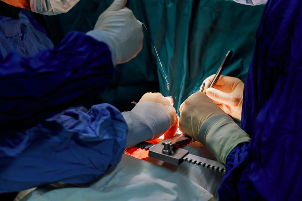 Surgeon hands are tying a knot during the open heart procedure chest during heart surgery